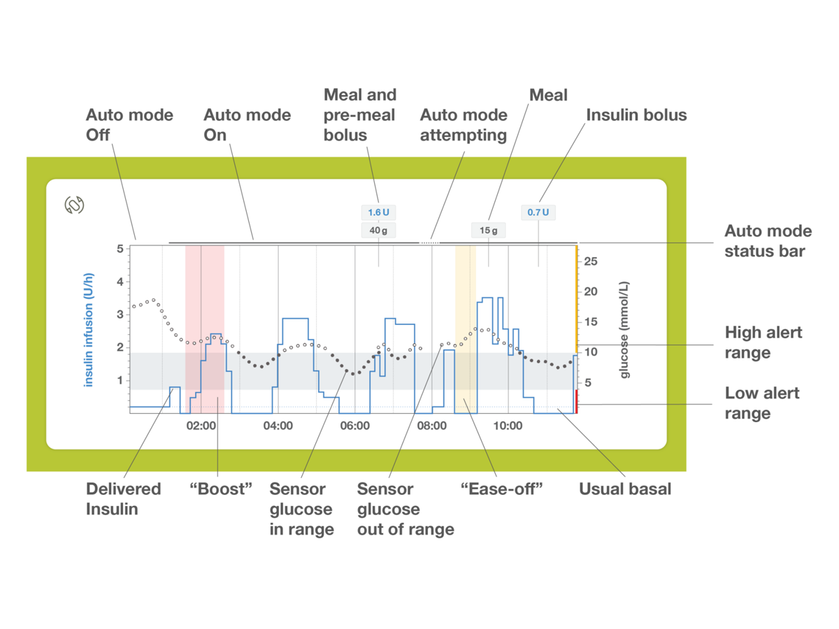 Mylifecamaps Automode Screen En Mmol Legende 02 880Bcbba